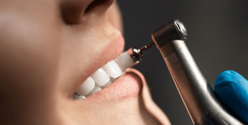 Seven corners family dentistry dental cleaning